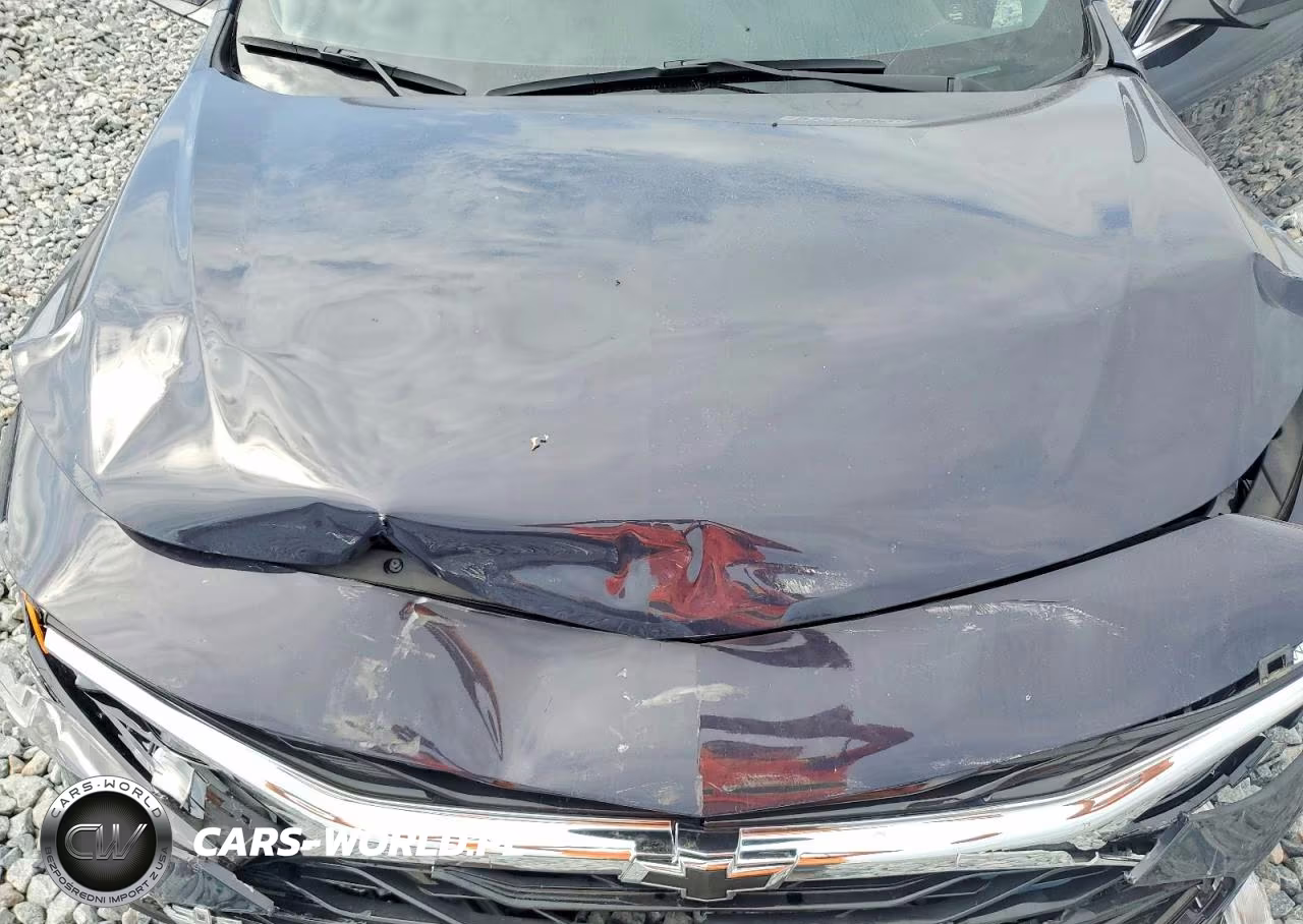 2025 Chevrolet Malibu Rs VIN:1G1ZG5ST9SF106026 - 11