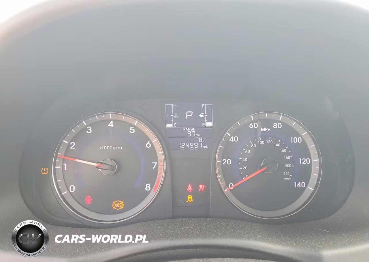 2016 Hyundai Accent Se VIN:KMHCT4AE6GU120812 - 9