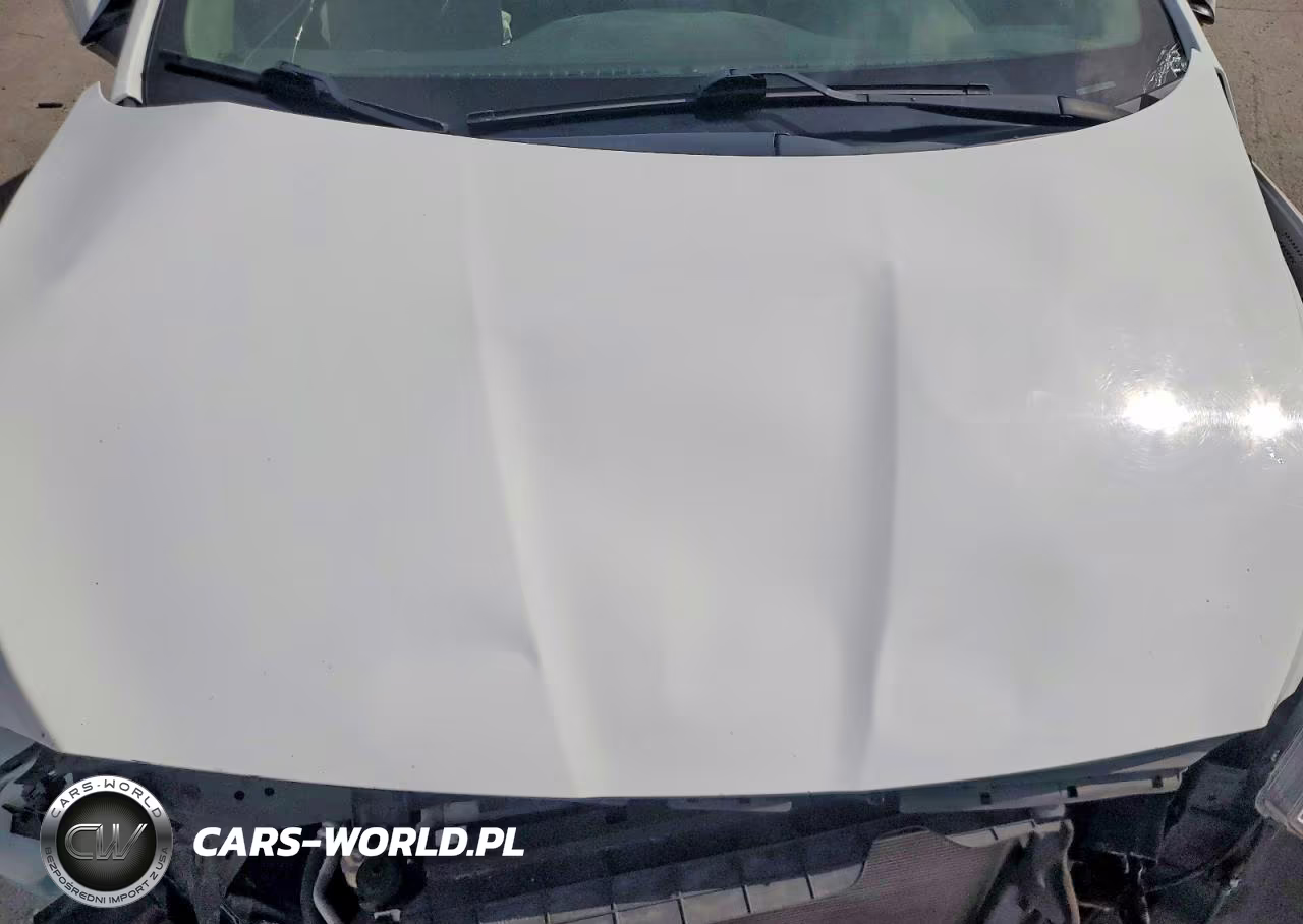 2017 Hyundai Accent Se VIN:KMHCT4AE9HU314557 - 11