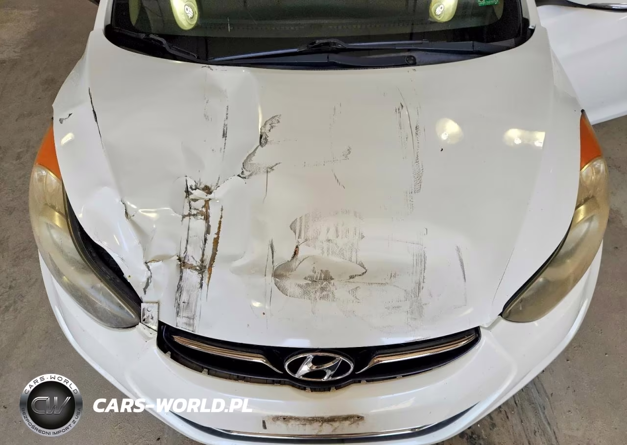 2011 Hyundai Elantra Limited VIN:5NPDH4AE3BH076149 - 11