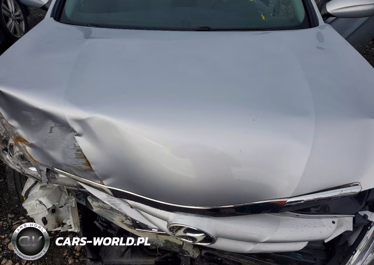 2013 Hyundai Sonata Gls VIN:5NPEB4AC9DH785854 - 11