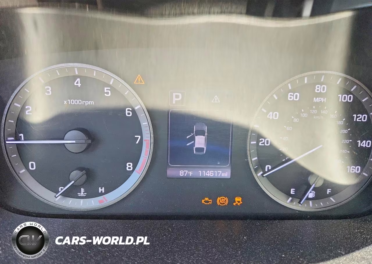 2017 Hyundai Sonata Se VIN:5NPE24AF2HH521987 - 9