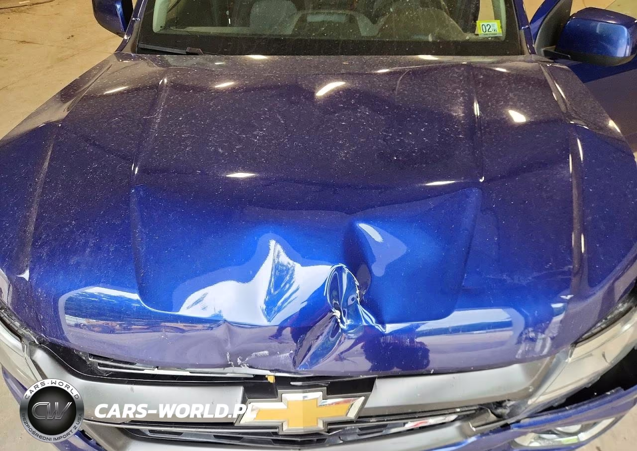 2015 Chevrolet Colorado Z71 VIN:1GCGTCE34F1273570 - 11