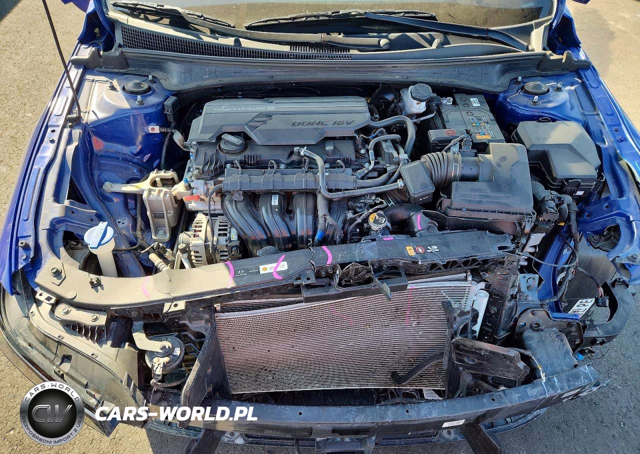 2024 Hyundai Elantra Sel VIN:KMHLS4DG8RU768316 - 11