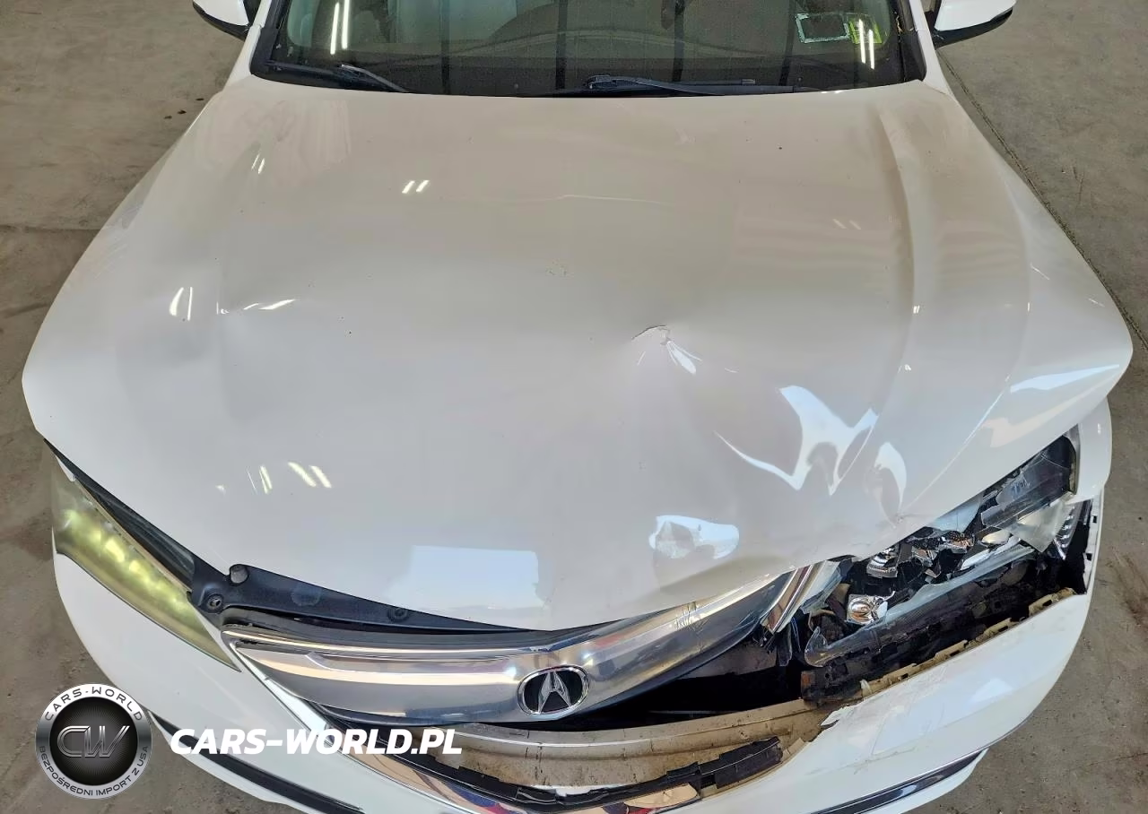 2015 Acura Tlx Tech VIN:19UUB1F51FA012778 - 11
