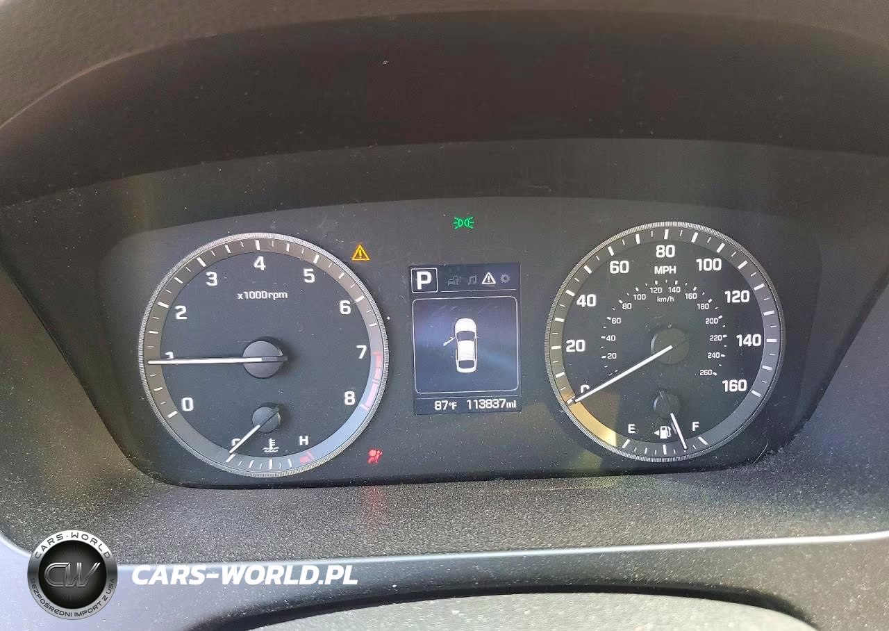 2017 Hyundai Sonata Se VIN:5NPE24AFXHH532204 - 9