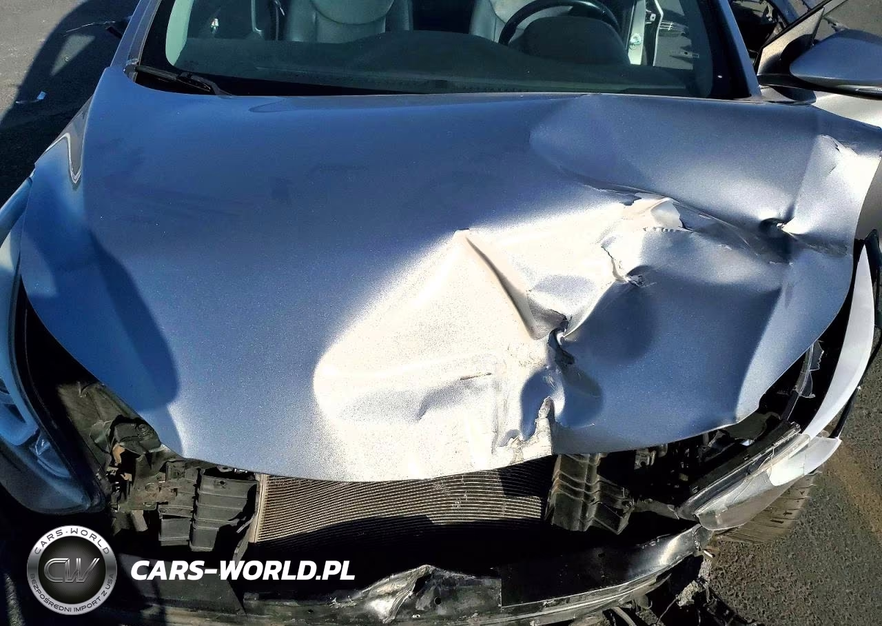 2015 Hyundai Elantra Limited VIN:KMHDH4AE0FU382149 - 11