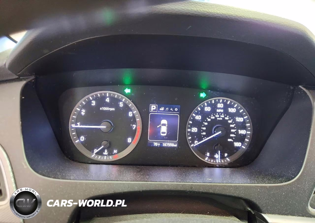 2017 Hyundai Sonata Se VIN:5NPE24AF7HH457820 - 9