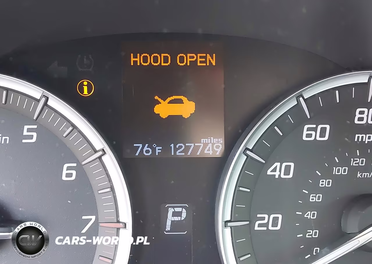 2015 Acura Tlx VIN:19UUB1F3XFA028072 - 15