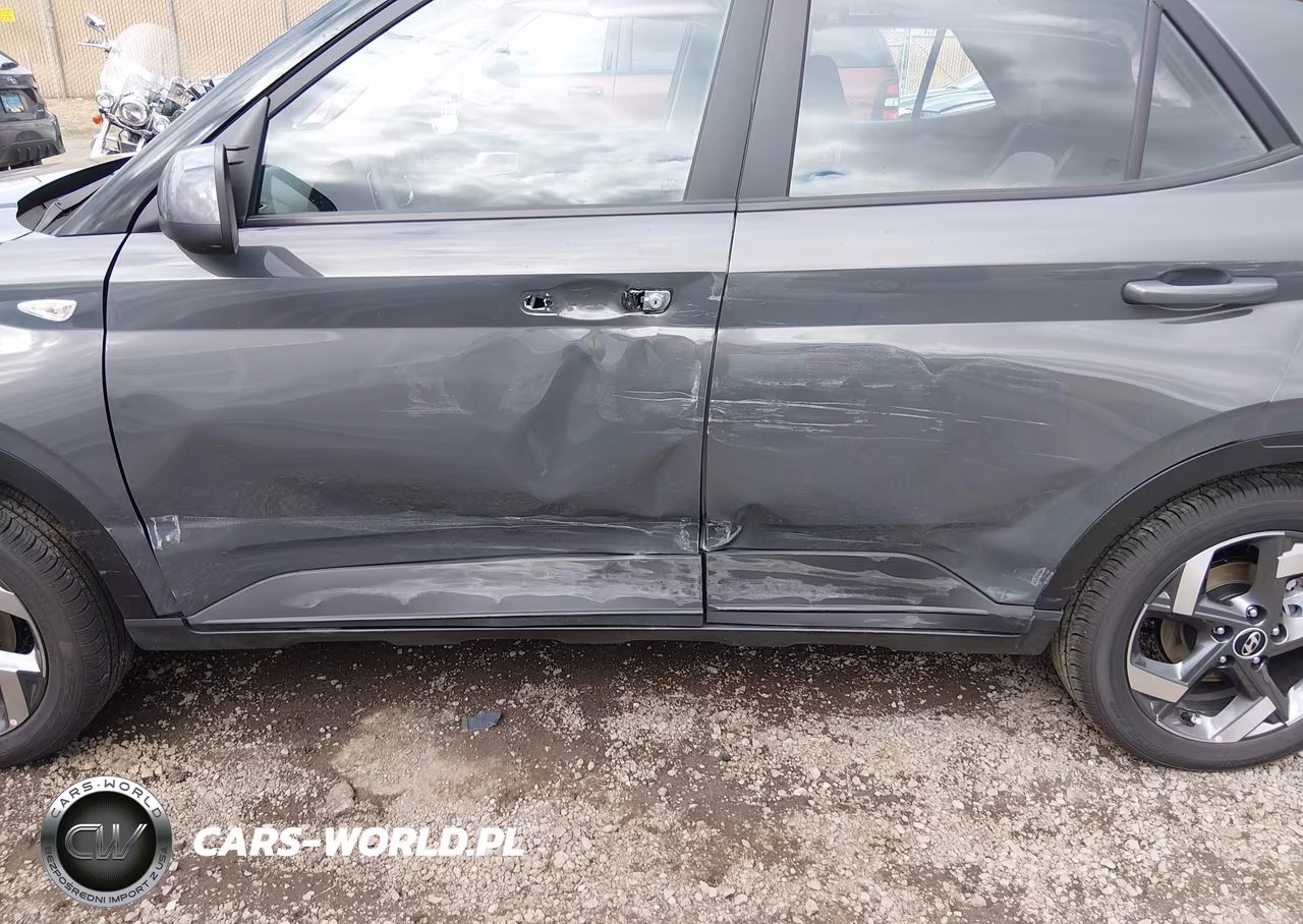 2026 Hyundai Venue Sel VIN:KMHRC8A39TU459123 - 6