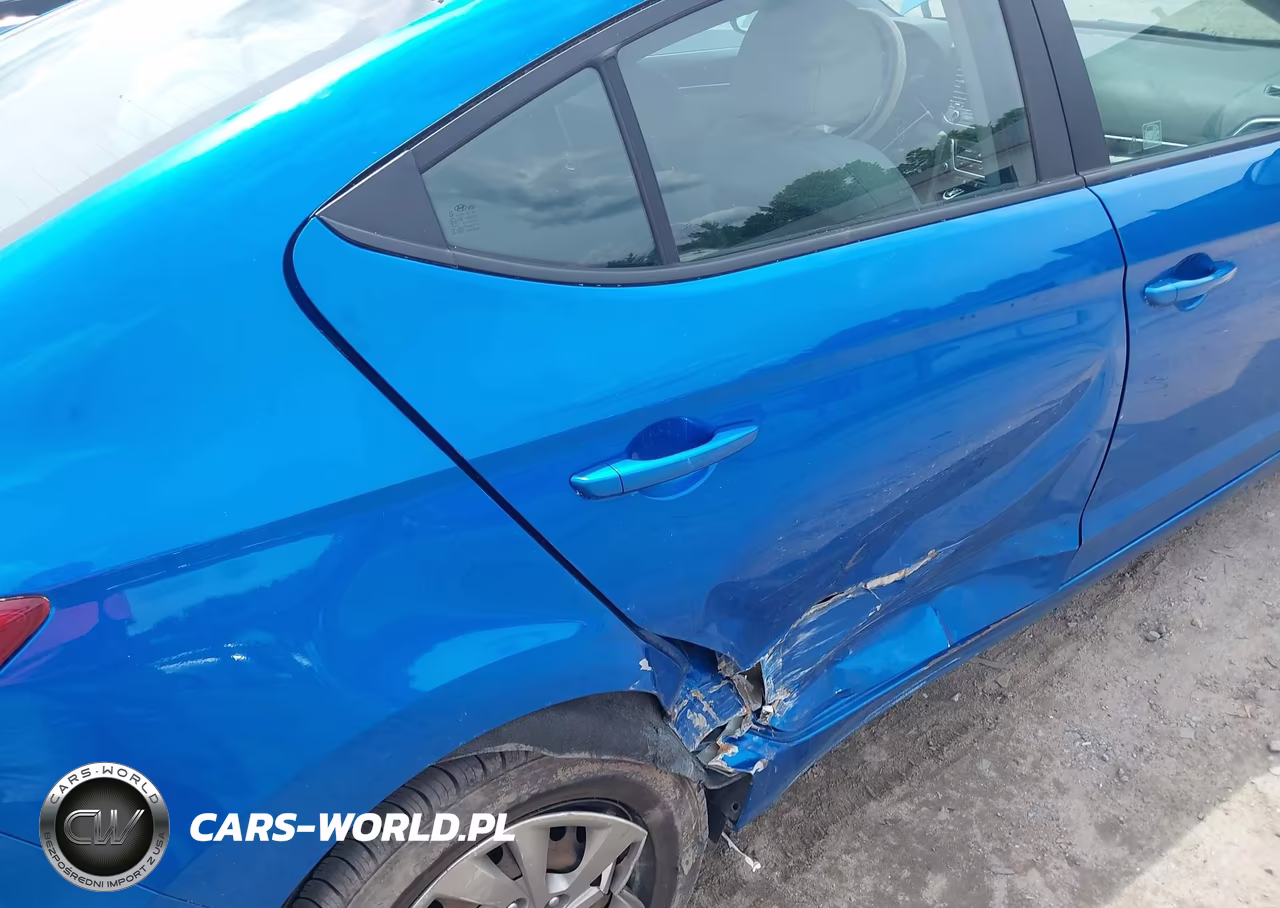 2017 Hyundai Elantra Se VIN:KMHD74LF9HU129245 - 6