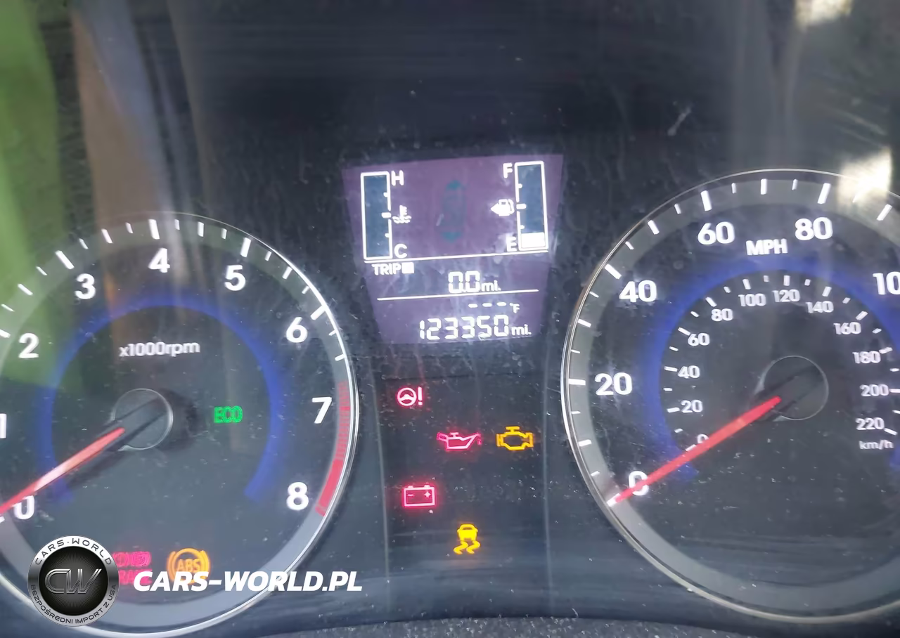 2017 Hyundai Accent Se VIN:KMHCT4AE5HU373718 - 7