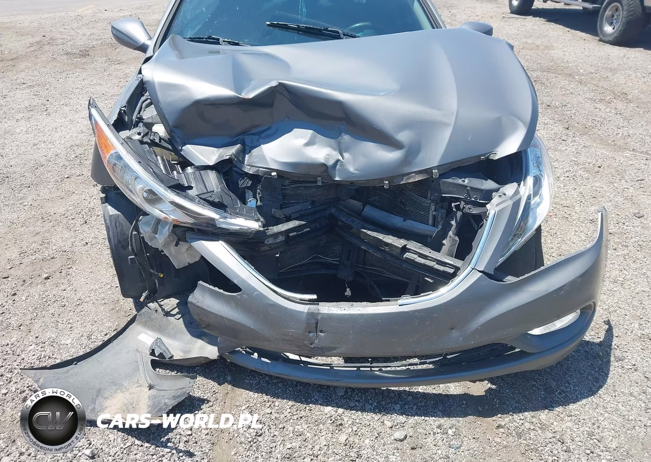 2013 Hyundai Sonata Gls VIN:5NPEB4AC2DH657035 - 6