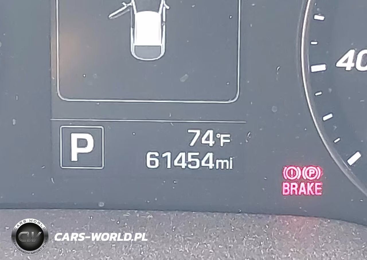 2017 Hyundai Veloster Turbo VIN:KMHTC6AE8HU309930 - 15