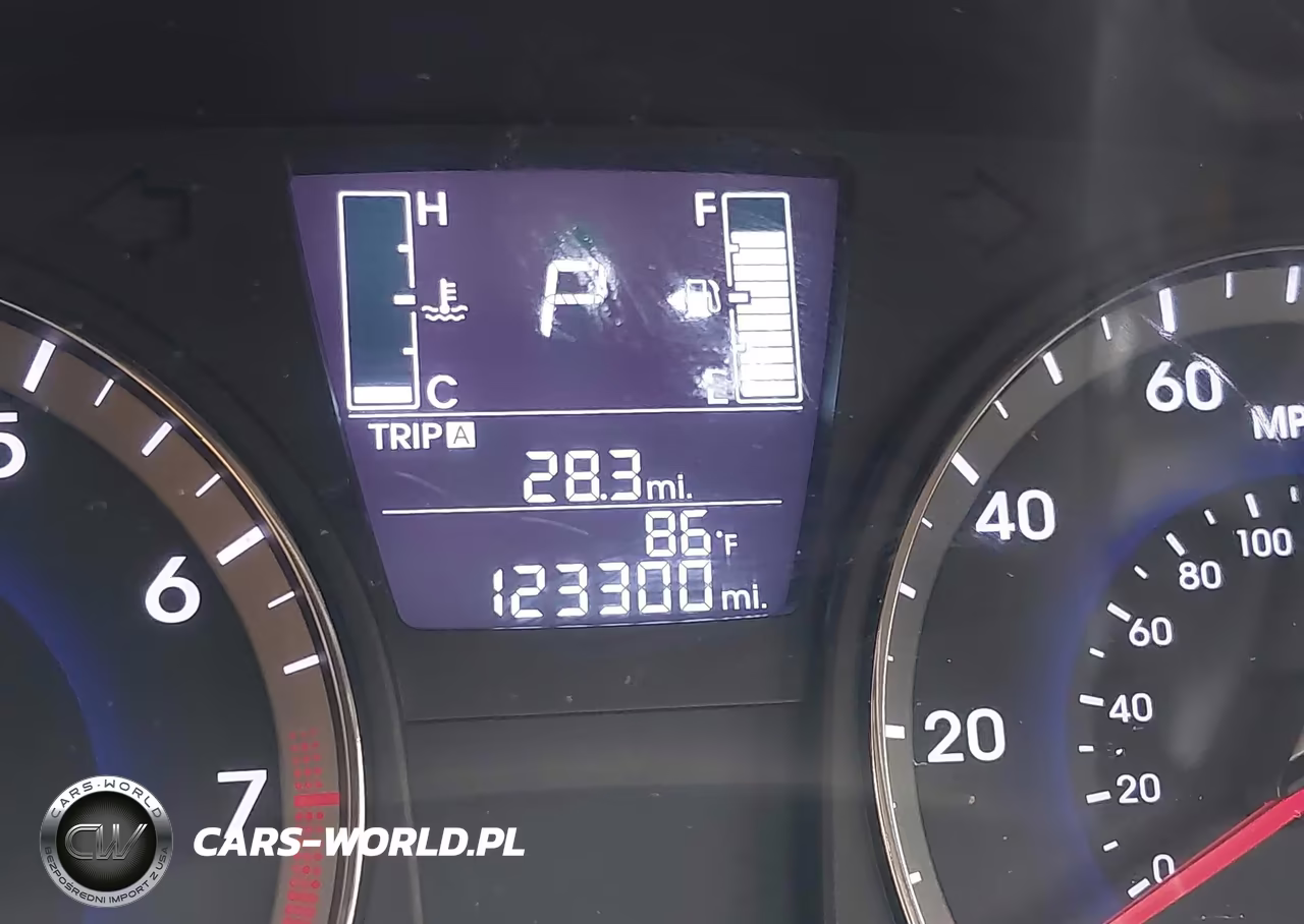 2015 Hyundai Accent Gls VIN:KMHCT4AE4FU915064 - 7