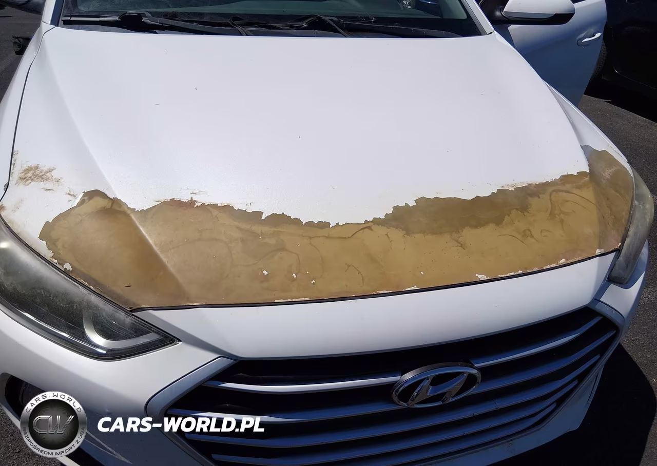 2017 Hyundai Elantra Se VIN:5NPD84LF7HH043282 - 6