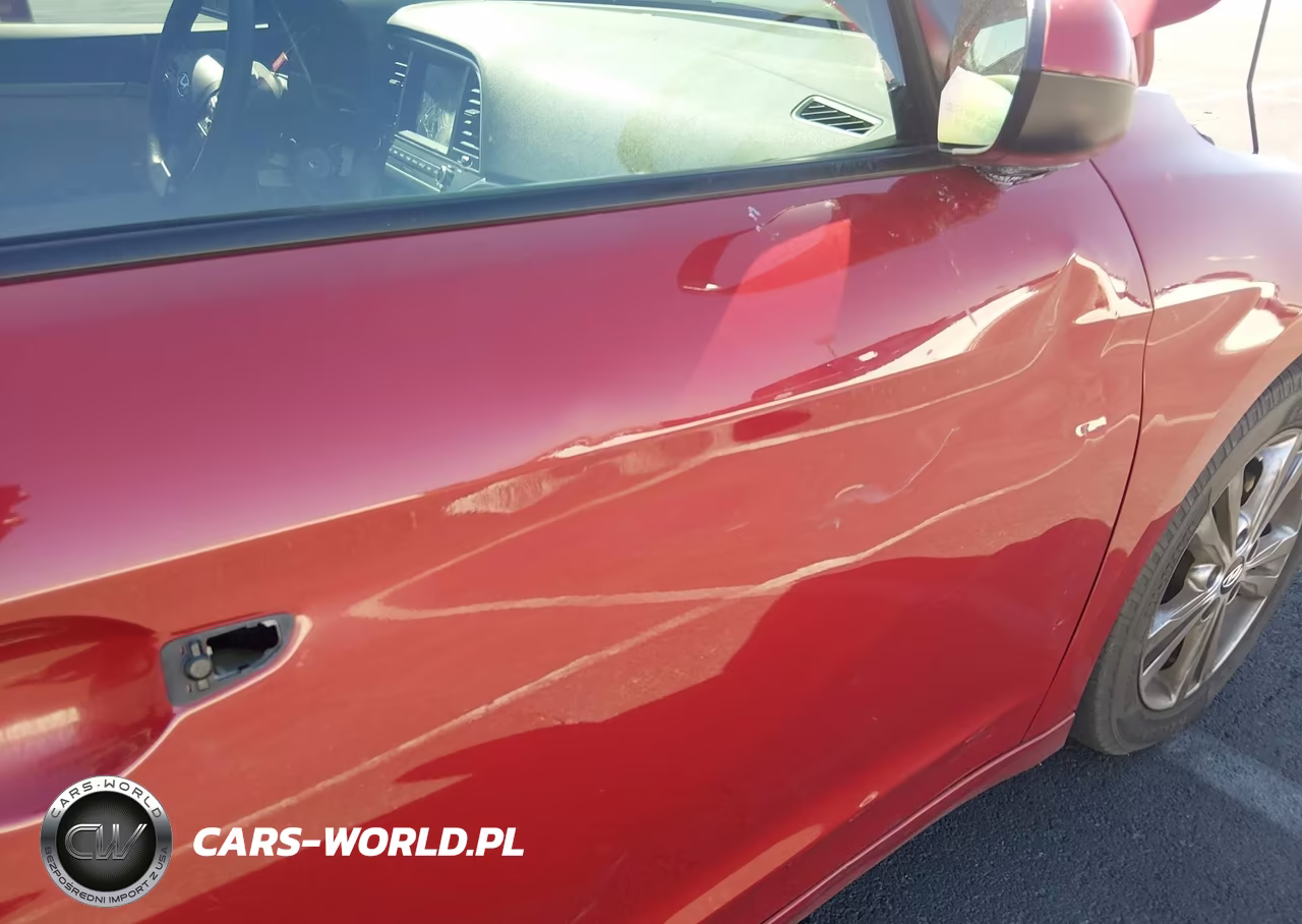 2017 Hyundai Elantra Se VIN:KMHD84LF3HU072523 - 18