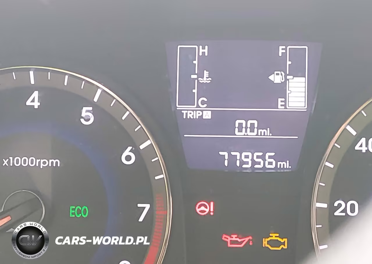 2016 Hyundai Accent Se VIN:KMHCT5AE6GU239143 - 15