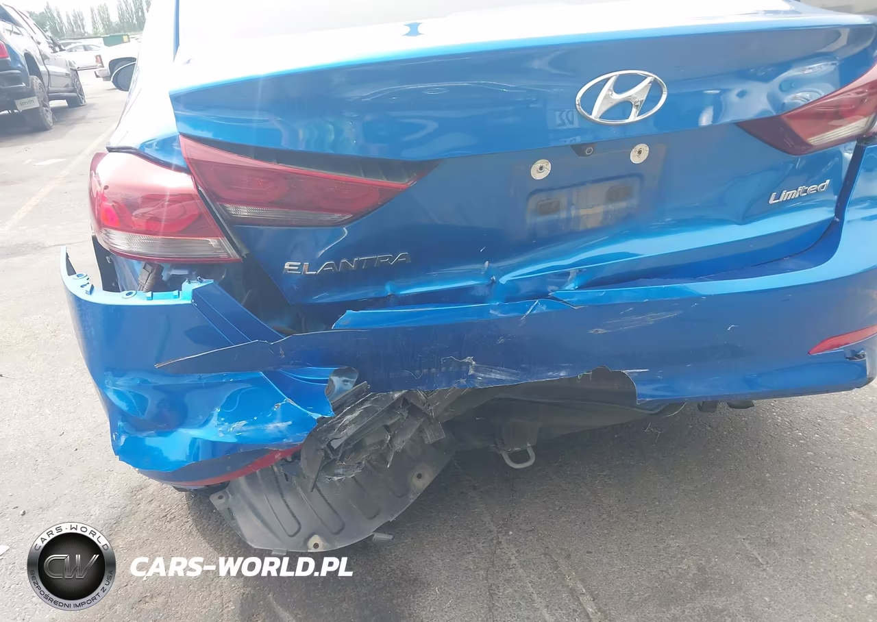 2017 Hyundai Elantra Limited VIN:5NPD84LF8HH036079 - 6