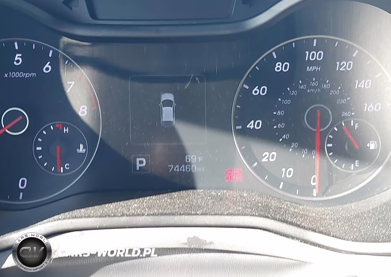 2017 Hyundai Veloster Turbo VIN:KMHTC6AEXHU313915 - 16