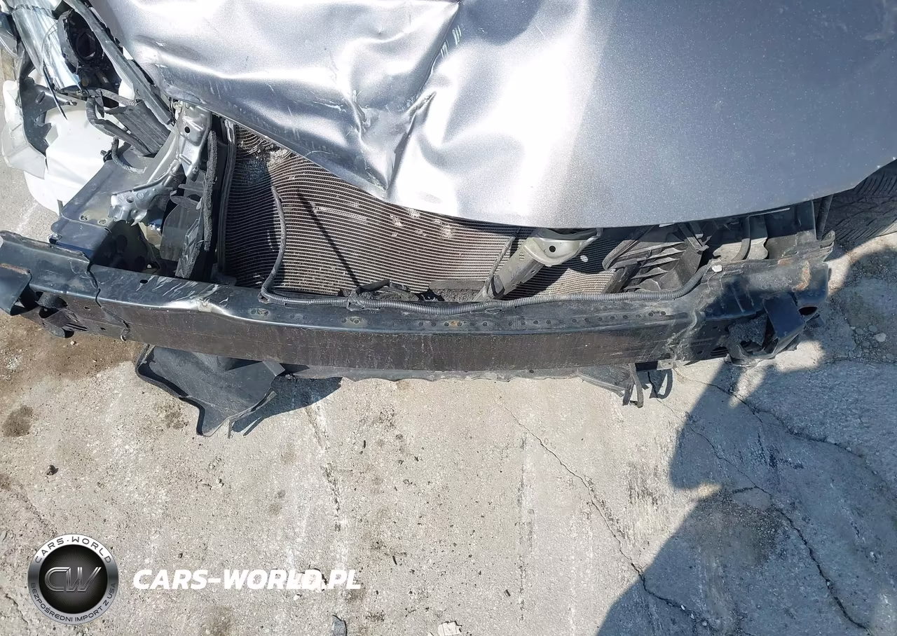 2017 Toyota Camry Se VIN:4T1BF1FK5HU321179 - 10
