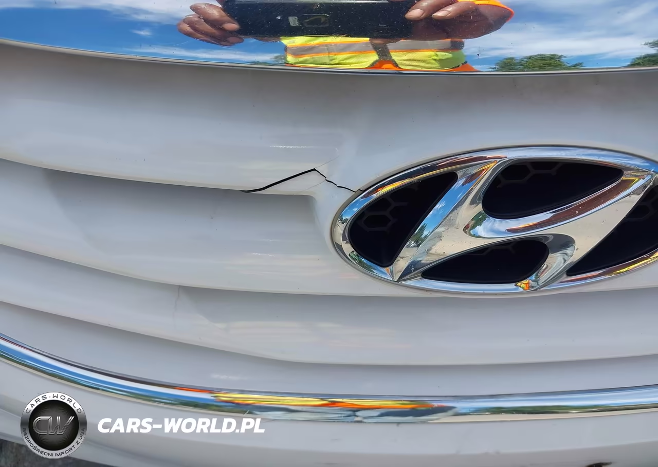 2011 Hyundai Sonata Gls VIN:5NPEB4AC7BH037231 - 17
