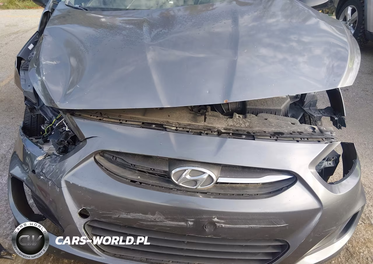 2015 Hyundai Accent Gls VIN:KMHCT4AE1FU885151 - 6