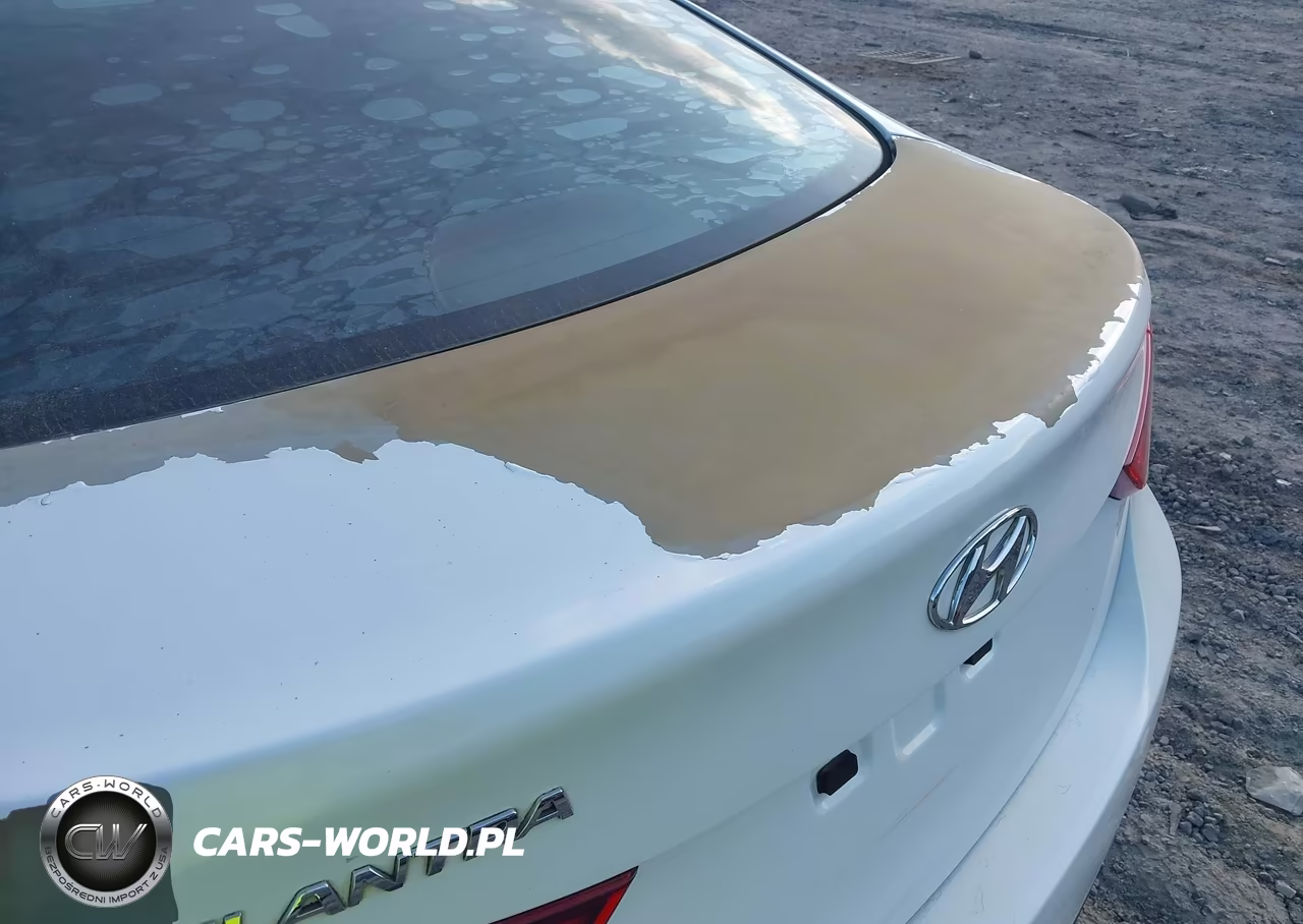 2016 Hyundai Elantra Se VIN:5NPDH4AE6GH690653 - 6
